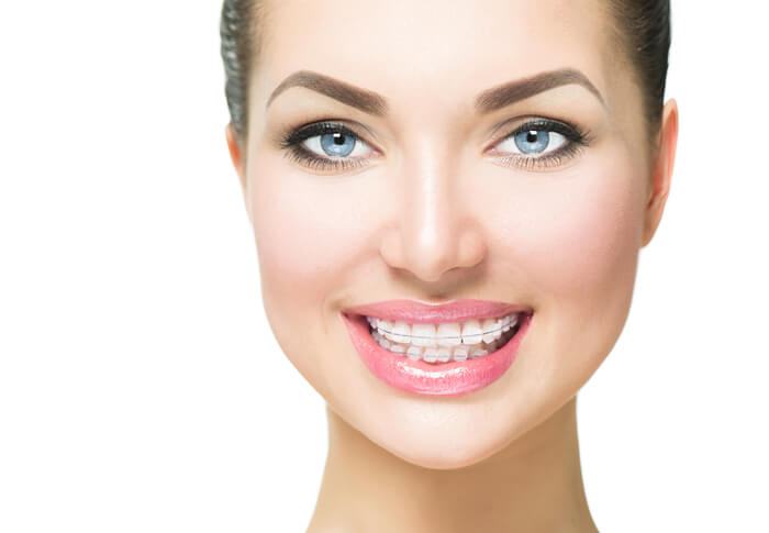 Know the available teeth straightening techniques in 2018